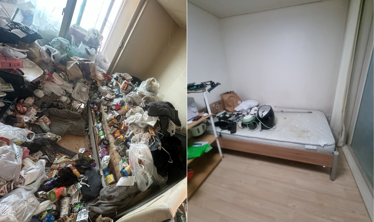 비포 애프터 사진